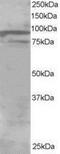 Oxysterol Binding Protein Like 11 antibody, NB100-1337, Novus Biologicals, Western Blot image 