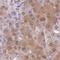 Sulfotransferase Family 1A Member 2 antibody, HPA051051, Atlas Antibodies, Immunohistochemistry paraffin image 