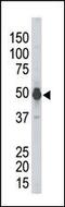 Phosphorylase Kinase Catalytic Subunit Gamma 2 antibody, MBS9210791, MyBioSource, Western Blot image 