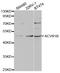 Activin A Receptor Type 1B antibody, LS-C334069, Lifespan Biosciences, Western Blot image 