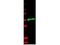 Interleukin 1 Receptor Type 2 antibody, TA319218, Origene, Western Blot image 