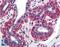 TNF Superfamily Member 13 antibody, LS-B2080, Lifespan Biosciences, Immunohistochemistry paraffin image 