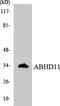 Abhydrolase Domain Containing 11 antibody, LS-C200071, Lifespan Biosciences, Western Blot image 