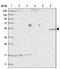 EPS8 Like 3 antibody, NBP2-13966, Novus Biologicals, Western Blot image 