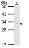 Proteasome Subunit Beta 4 antibody, NBP1-32009, Novus Biologicals, Western Blot image 