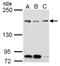 Tonsoku Like, DNA Repair Protein antibody, NBP2-19531, Novus Biologicals, Western Blot image 