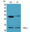 Tissue Factor Pathway Inhibitor 2 antibody, STJ96524, St John
