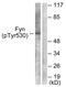 FYN Proto-Oncogene, Src Family Tyrosine Kinase antibody, PA5-38115, Invitrogen Antibodies, Western Blot image 