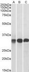 EF-Hand Domain Family Member D2 antibody, STJ70621, St John