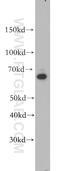 Solute Carrier Family 22 Member 15 antibody, 20626-1-AP, Proteintech Group, Western Blot image 