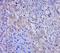 Proteasome Activator Subunit 2 antibody, orb312513, Biorbyt, Immunohistochemistry paraffin image 