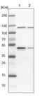 Rho Guanine Nucleotide Exchange Factor 10 antibody, PA5-55139, Invitrogen Antibodies, Western Blot image 