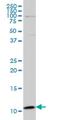 Plasminogen Like B2 antibody, H00005342-M04, Novus Biologicals, Western Blot image 