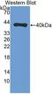 Prolyl 4-Hydroxylase Subunit Alpha 3 antibody, LS-C373252, Lifespan Biosciences, Western Blot image 