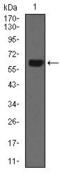 Keratin 5 antibody, GTX60722, GeneTex, Western Blot image 