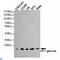 Chromobox 3 antibody, LS-C812998, Lifespan Biosciences, Western Blot image 