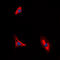 Interleukin 10 Receptor Subunit Alpha antibody, LS-C359025, Lifespan Biosciences, Immunofluorescence image 