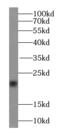 TAGLN2 antibody, FNab08933, FineTest, Western Blot image 