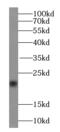 Transgelin 2 antibody, FNab08933, FineTest, Western Blot image 