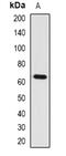 Interleukin 1 Receptor Type 1 antibody, abx225242, Abbexa, Western Blot image 