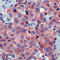 Catenin Beta 1 antibody, LS-C88416, Lifespan Biosciences, Immunohistochemistry paraffin image 