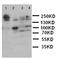 Laminin Subunit Gamma 2 antibody, orb76096, Biorbyt, Western Blot image 