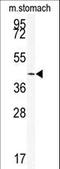 Sirtuin 6 antibody, LS-C100492, Lifespan Biosciences, Western Blot image 