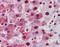 Nucleophosmin 1 antibody, 48-050, ProSci, Immunohistochemistry paraffin image 