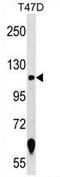 Zinc Finger Protein 217 antibody, AP54677PU-N, Origene, Western Blot image 