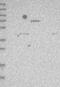 Unk Zinc Finger antibody, NBP1-89595, Novus Biologicals, Western Blot image 