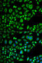 Apolipoprotein D antibody, STJ27250, St John