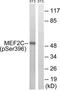 Myocyte-specific enhancer factor 2C antibody, TA326044, Origene, Western Blot image 