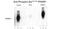 Interferon Alpha And Beta Receptor Subunit 1 antibody, GTX82662, GeneTex, Western Blot image 