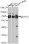 Aldehyde Dehydrogenase 4 Family Member A1 antibody, A13569, ABclonal Technology, Western Blot image 