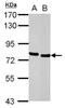 Hematopoietic Cell-Specific Lyn Substrate 1 antibody, NBP1-30953, Novus Biologicals, Western Blot image 