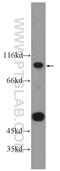 Ankyrin Repeat Domain 6 antibody, 24333-1-AP, Proteintech Group, Western Blot image 