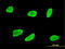 Serum/Glucocorticoid Regulated Kinase 1 antibody, LS-B5535, Lifespan Biosciences, Immunofluorescence image 
