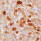 Hepsin antibody, MAB47761, R&D Systems, Immunohistochemistry paraffin image 