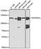 Methylenetetrahydrofolate Dehydrogenase (NADP+ Dependent) 1 Like antibody, A7969, ABclonal Technology, Western Blot image 