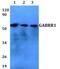 Gamma-Aminobutyric Acid Type A Receptor Rho1 Subunit antibody, PA5-75773, Invitrogen Antibodies, Western Blot image 