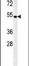 Coronin 6 antibody, PA5-24759, Invitrogen Antibodies, Western Blot image 