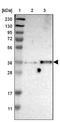 Purinergic Receptor P2Y1 antibody, NBP1-82439, Novus Biologicals, Western Blot image 