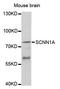 Sodium Channel Epithelial 1 Alpha Subunit antibody, LS-C334121, Lifespan Biosciences, Western Blot image 