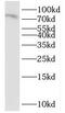 Interleukin 17 Receptor E antibody, FNab04232, FineTest, Western Blot image 