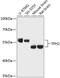 Tryptophan Hydroxylase 2 antibody, 15-582, ProSci, Western Blot image 