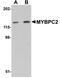 Myosin Binding Protein C, Fast Type antibody, NBP1-77133, Novus Biologicals, Western Blot image 