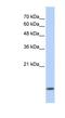 Dynein Light Chain LC8-Type 1 antibody, NBP1-54970, Novus Biologicals, Western Blot image 