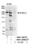 SLX4 Structure-Specific Endonuclease Subunit antibody, NBP1-28679, Novus Biologicals, Immunoprecipitation image 