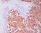 Aldehyde Dehydrogenase 1 Family Member A1 antibody, M01392-1, Boster Biological Technology, Immunohistochemistry paraffin image 