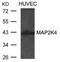 Mitogen-Activated Protein Kinase Kinase 4 antibody, 79-657, ProSci, Western Blot image 